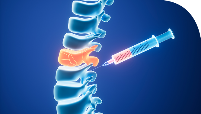 �Ű����ܼ��� Ư¡