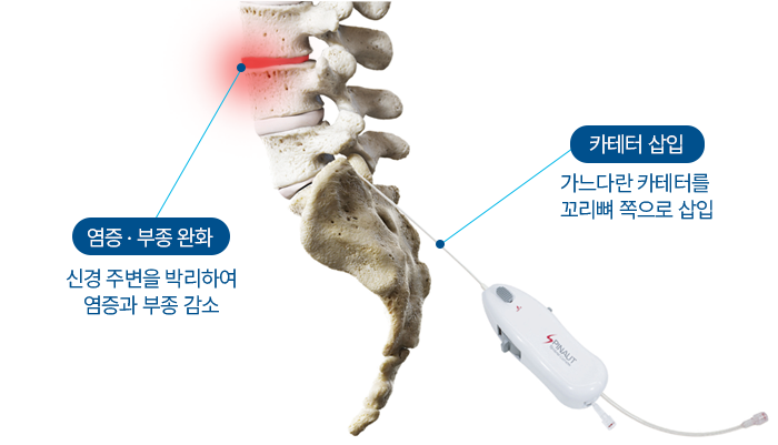 �Ű漺������ Ư¡