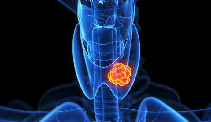 ���� ����